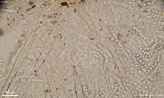 Lasiobolus microsporus