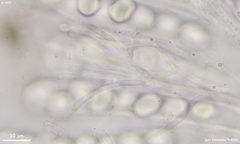 Lasiobolus microsporus