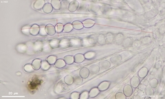 Lasiobolus microsporus