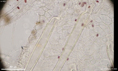 Lasiobolus microsporus
