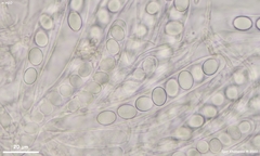 Lasiobolus microsporus