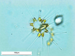 Asterionellopsis