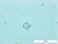 Protoperidinium