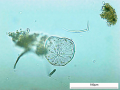 Asteromphalus