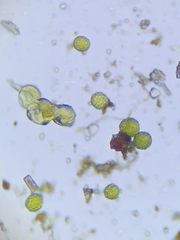 Sphaerocarpos europaeus