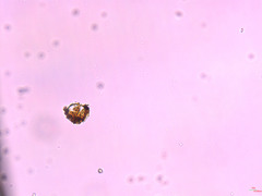 Chytridiomycota
