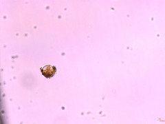 Chytridiomycota