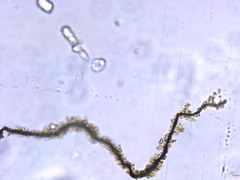 Microcystaceae