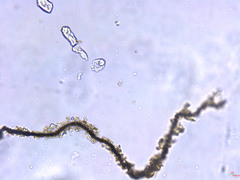 Microcystaceae