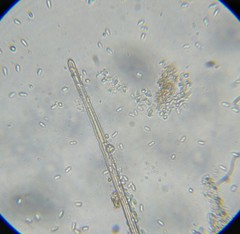 Volutella ciliata