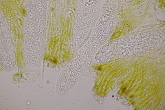 Pezicula ocellata