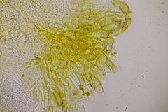 Pezicula ocellata