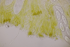 Pezicula ocellata