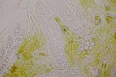 Pezicula ocellata