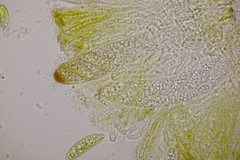 Pezicula ocellata
