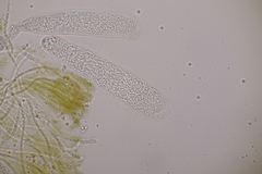 Pezicula ocellata