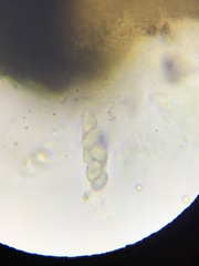 Verrucaria praetermissa