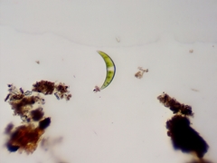 Closterium moniliferum