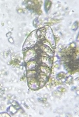 Bolivina