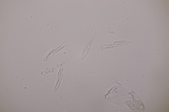 Apiognomonia hystrix