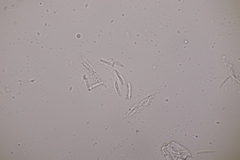 Apiognomonia hystrix