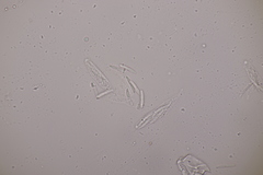 Apiognomonia hystrix