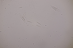 Apiognomonia hystrix