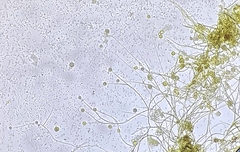 Cosmospora khandalensis