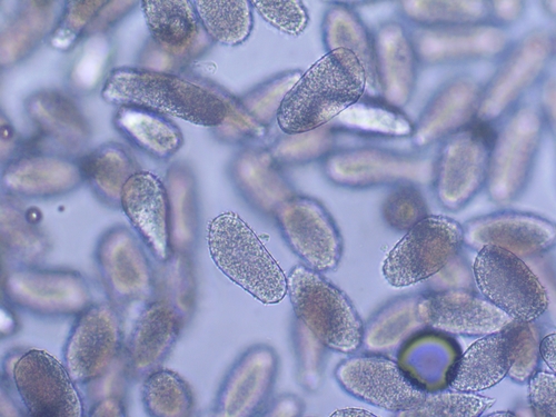 Hart's-tongue Fern Rust