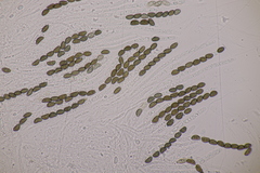 Jackrogersella cohaerens