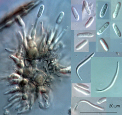 Phomopsis cunninghamii