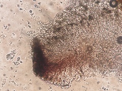 Bacidia crenulata