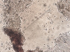 Bacidia crenulata