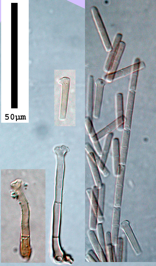 Polyscytalum gracilisporum