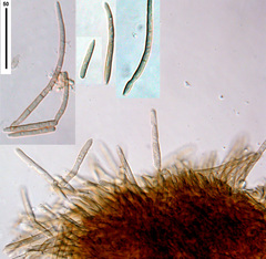 Pseudocercospora ackamae