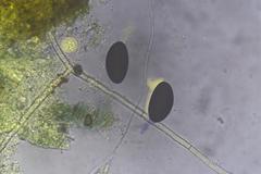 Podospora excentrica