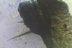 Podospora excentrica