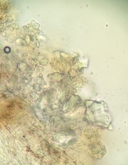 Radulomyces confluens