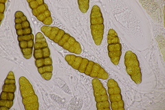 Prosthemium betulinum