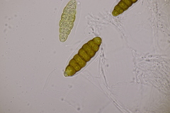 Prosthemium betulinum