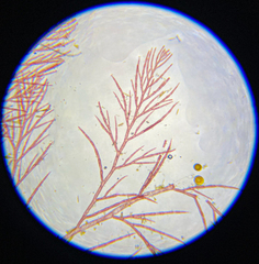 Callithamnion acutum