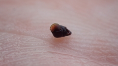 Barleeia unifasciata