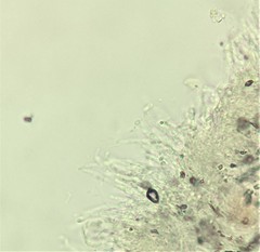 Ascomycota