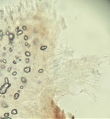 Ascomycota