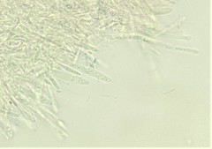 Ascomycota