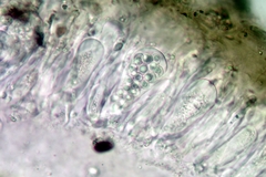 Melanohalea multispora