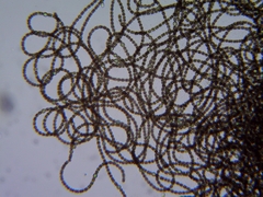 Dolichospermum