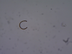 Dolichospermum