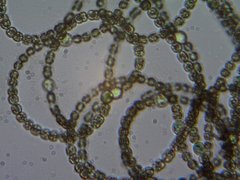 Dolichospermum