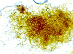 Oligonema persimile